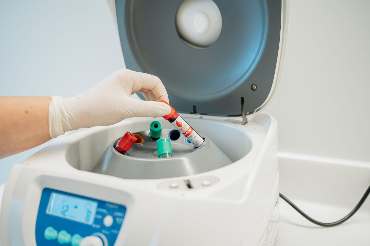 Zahnmedizinische Fachangestellte entnimmt ein Reagenzglas mit Blutproben aus der PRF-Zentrifuge.